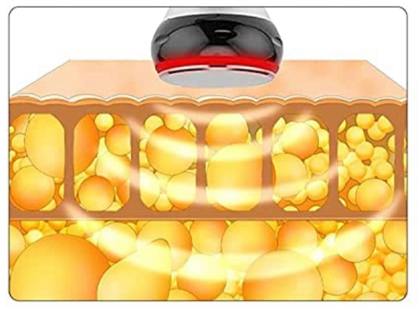 40K Ultrasonic Cavitation: Three 30 min Session